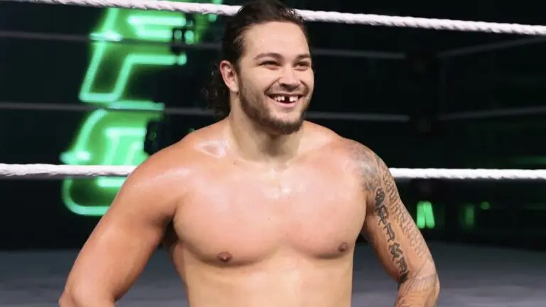 Shiloh Hill Explains The Origins Of His Missing Tooth