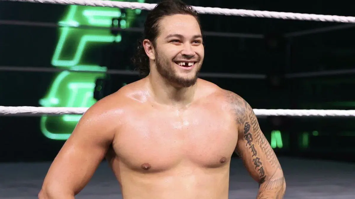 Shiloh Hill Explains The Origins Of His Missing Tooth